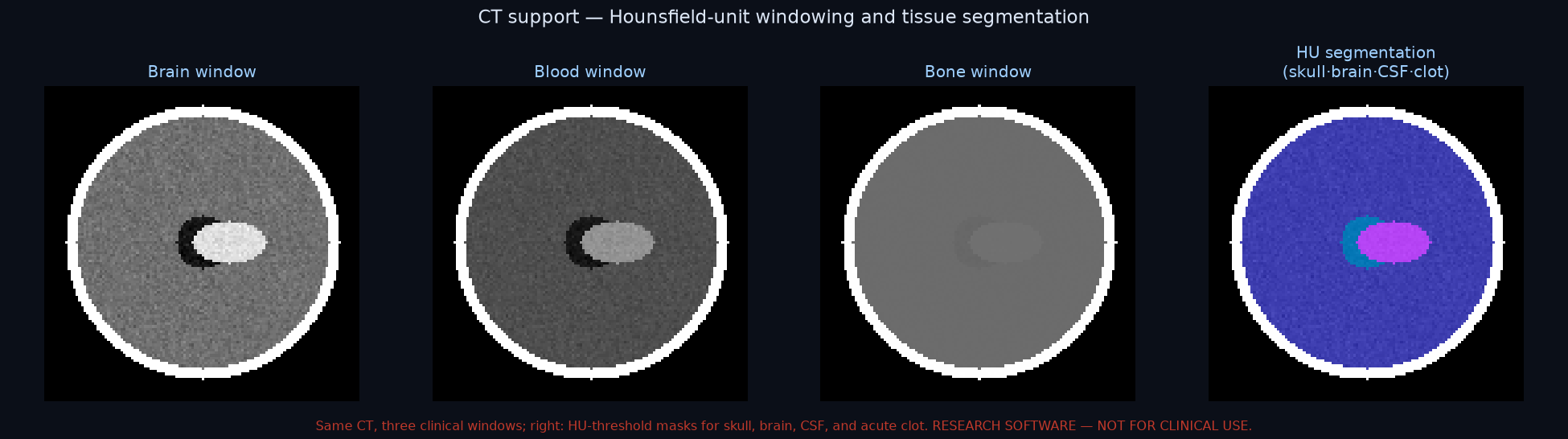 CT support β windowing and segmentation