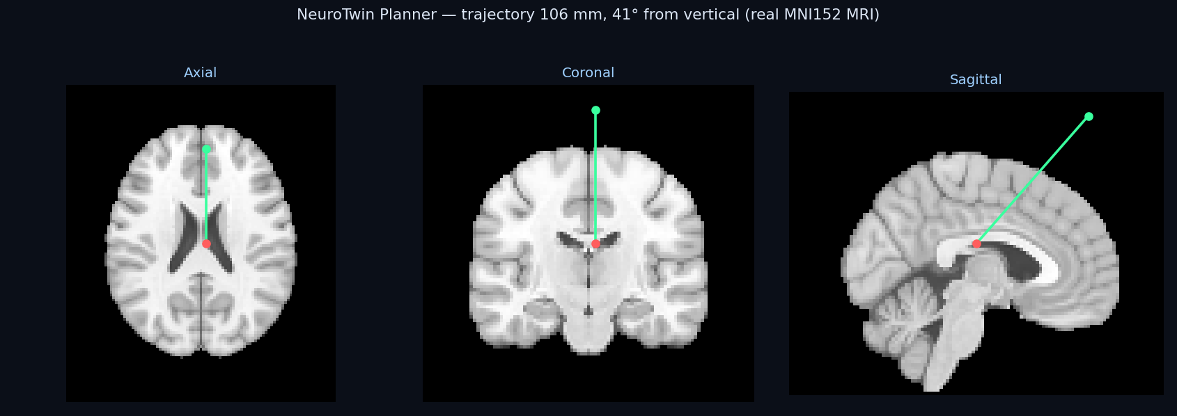 Multiplanar trajectory