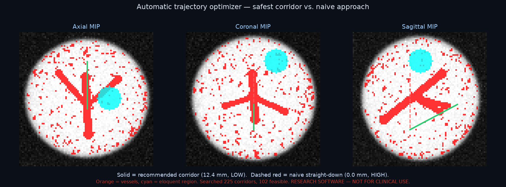 Automatic trajectory optimizer
